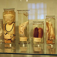 A hassle-free and cost-free method